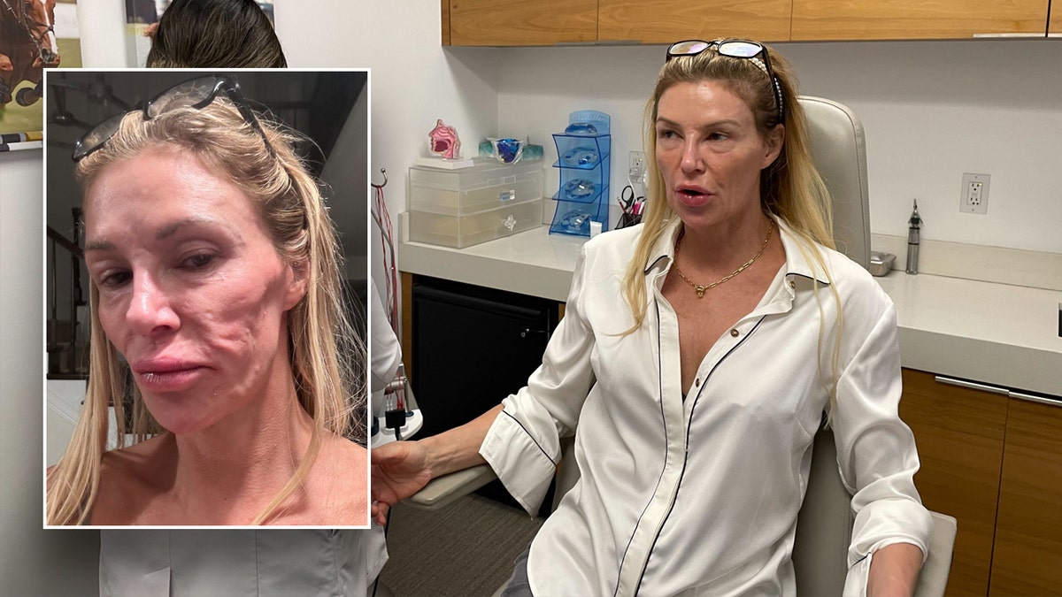 Brandi Glanville revealed a parasitic infection scandal that destroyed